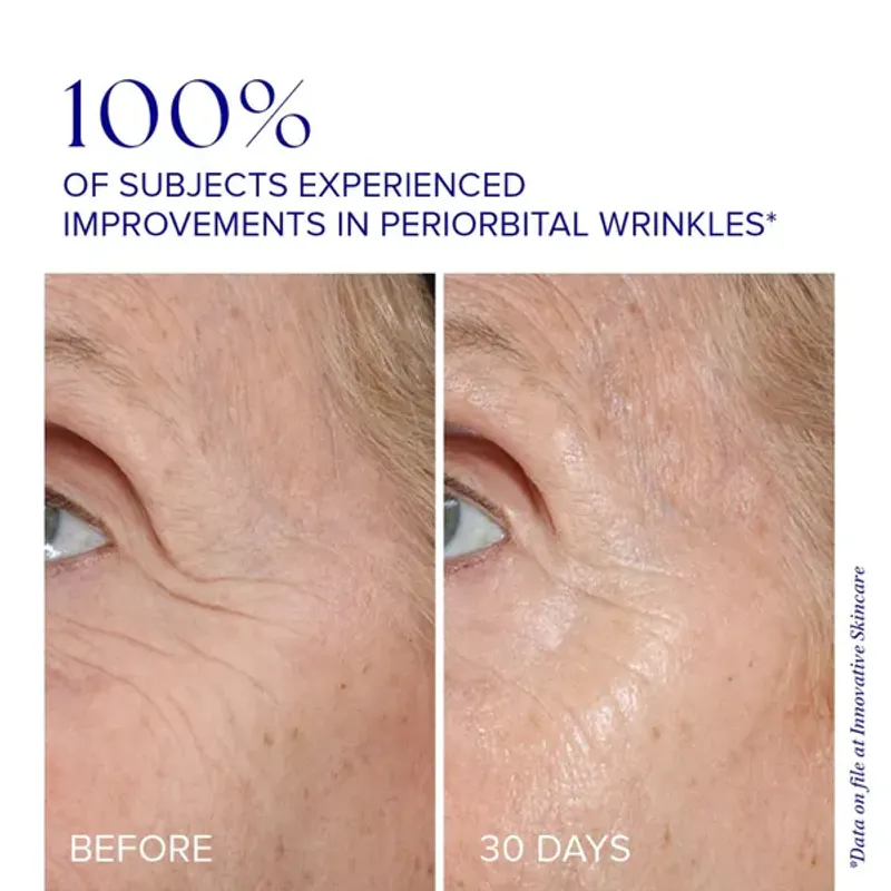 YOUTH eye complex 15 g 